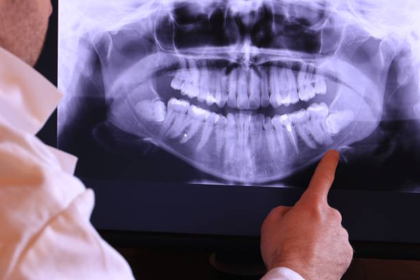 Best Emergency Gum Treatment in Bryson City, NC