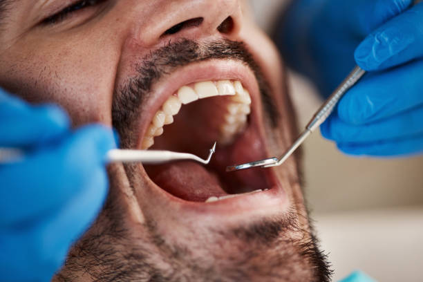 Best Weekend Emergency Dentist in Bryson City, NC