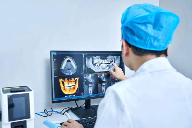 Best Emergency Wisdom Teeth Removal in Bryson City, NC