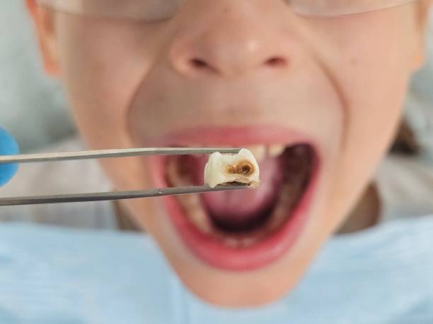 Best After-Hours Dental Trauma Care in Bryson City, NC